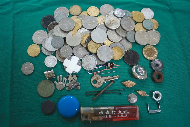硬币、纽扣、别针……什么都敢吃！儿科专家提醒→